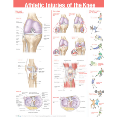 Athletic Injuries of the Knee Anatomical Chart