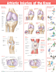 Athletic Injuries of the Knee Anatomical Chart 